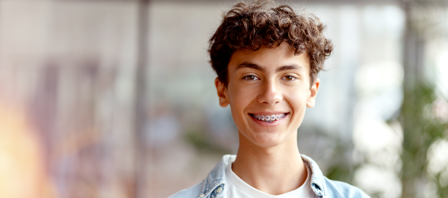 Foto de um garoto, com idade por volta de 15 anos, sorrindo. Ele é branco, tem cabelos castanhos, usa aparelho nos dentes e veste uma camisa jeans sobre uma camiseta branca. Do lado esquerdo da foto, há o texto “Plano Alfa Orto. Dentes e sorriso perfeitos ao alcance de todos. Apenas R$ 146,00 por mês